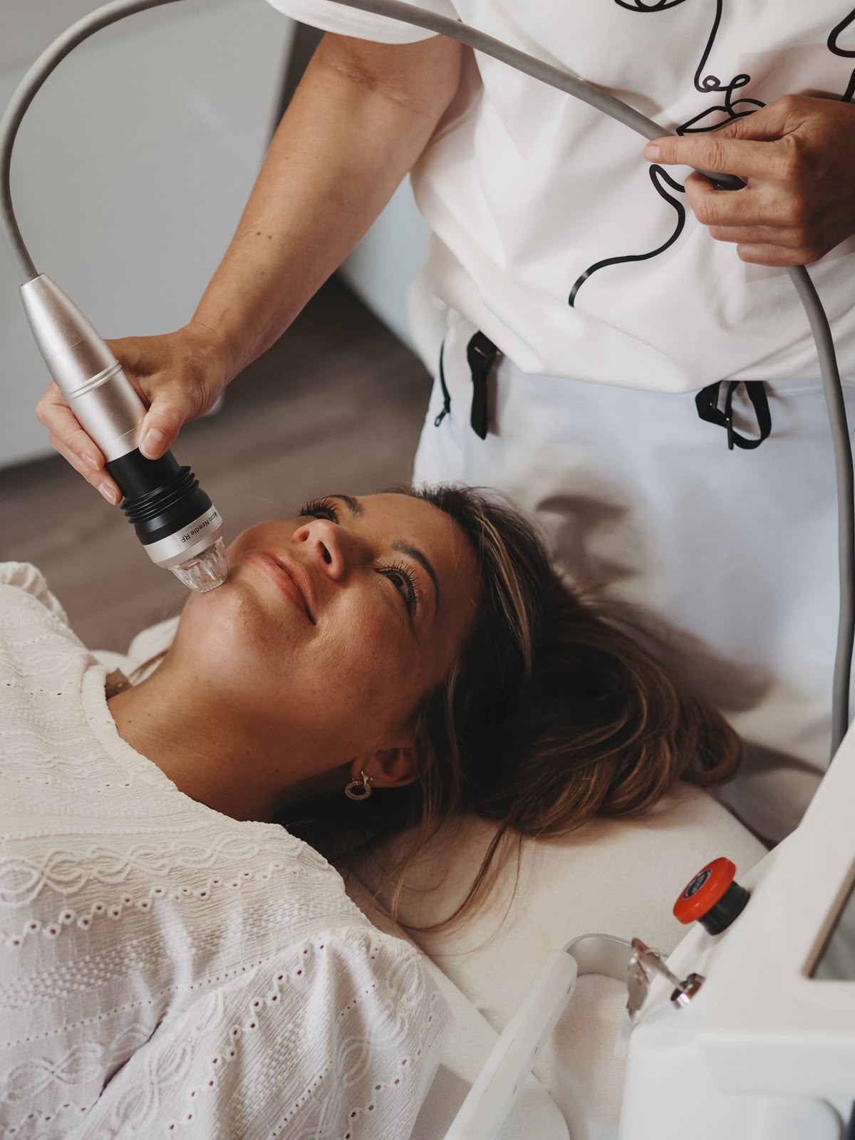 Eigenplasma- und RF-Microneedling-Behandlung bei Hautgefühl